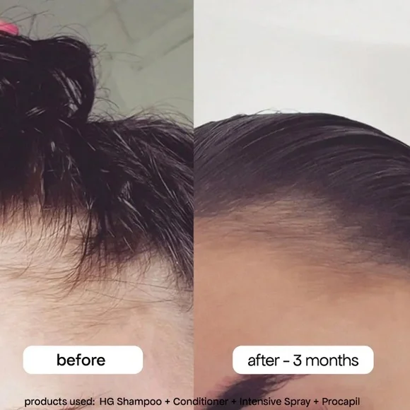 Bondi Boost Intensive Spray - Picture 3 of 7